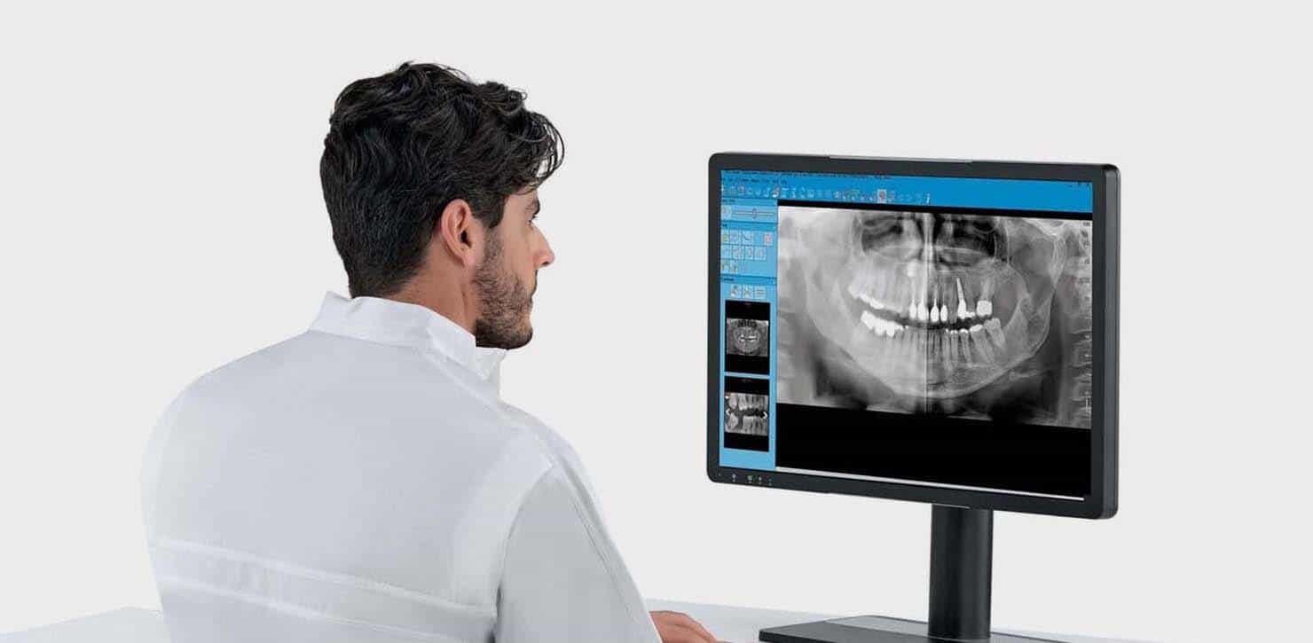 diagnosi denti con radiografia